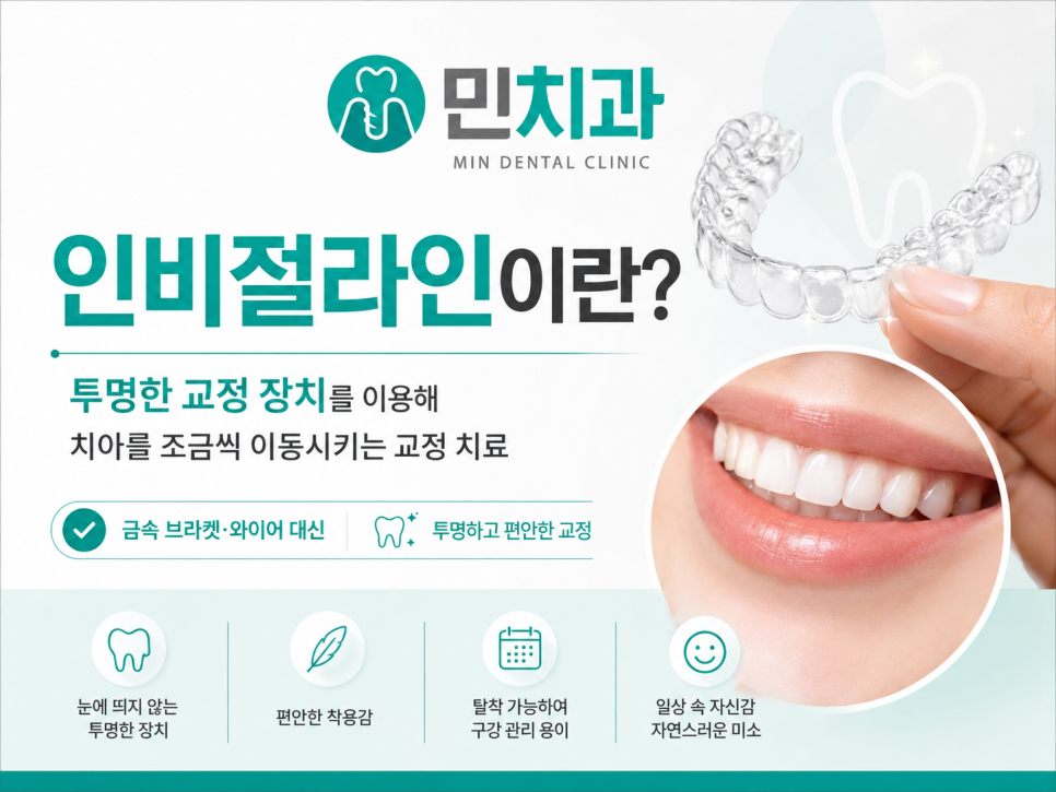 투명교정 전 확인할 사항 안내