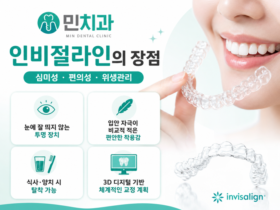 인비절라인 투명 장치와 치아 이동 방식